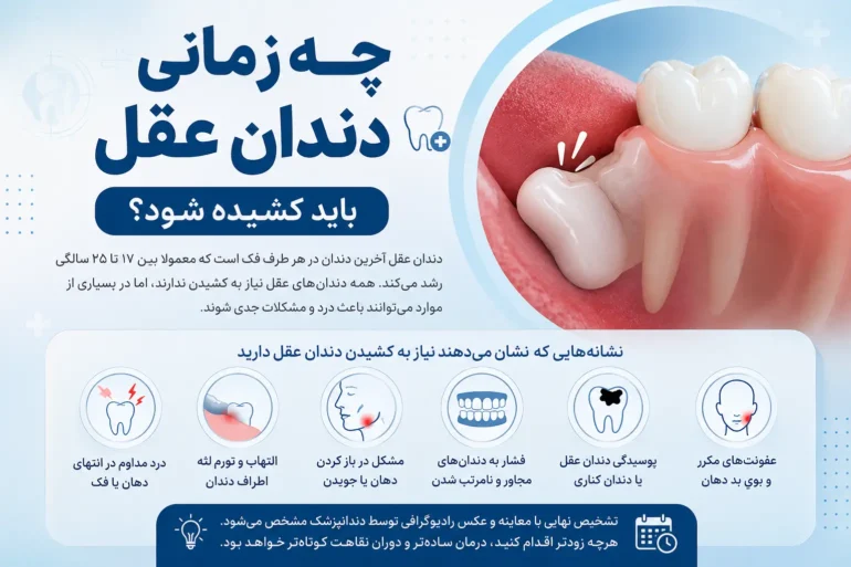 چه زمانی دندان عقل باید کشیده شود؟ ۷ نشانه مهم